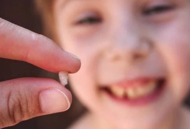 Giấc mơ thấy răng bị gãy, rụng là một trong những giấc mơ khá phổ biến