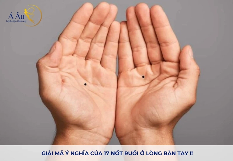 giai-ma-y-nghia-not-ruoi-trong-long-ban-tay-van-menh-va-tinh_908