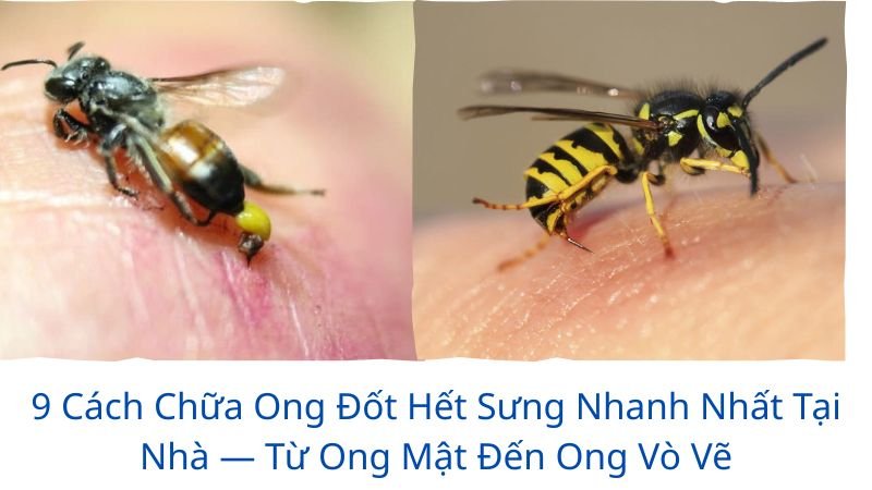 cách chữa ong đốt hết sưng nhanh nhất