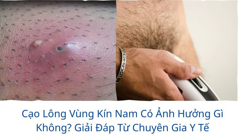 cạo lông vùng kín nam có ảnh hưởng gì không