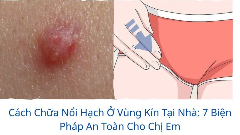 cách chữa nổi hạch ở vùng kín tại nhà