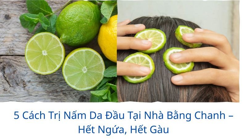 trị nấm da đầu tại nhà bằng chanh