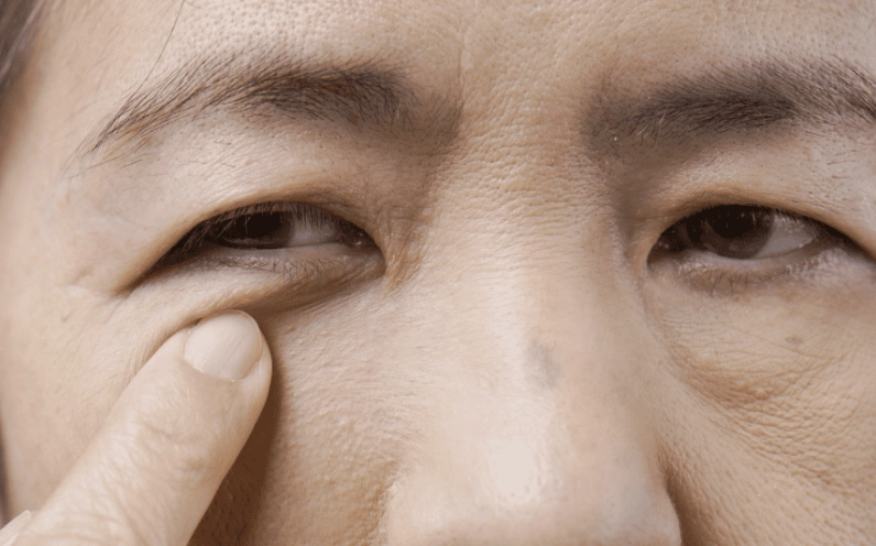 mắt phải giật là dấu hiệu cảnh báo bệnh gì