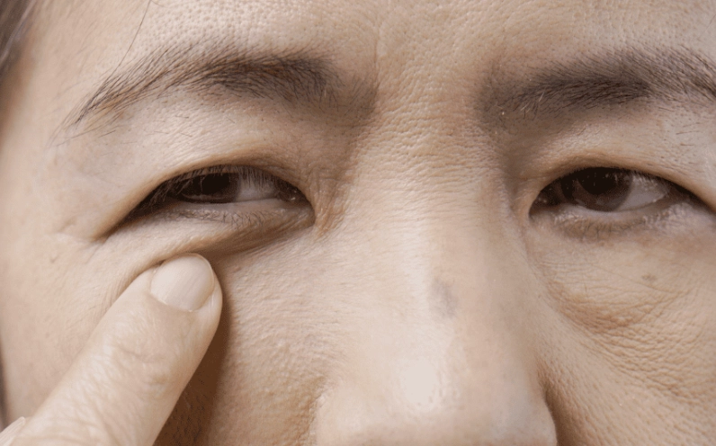 mắt phải giật là dấu hiệu cảnh báo bệnh gì