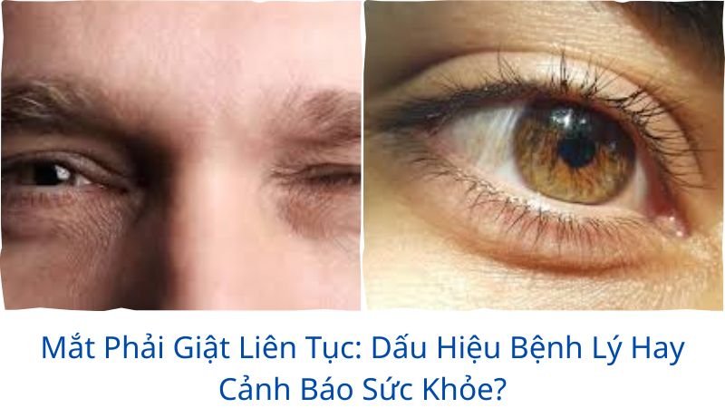 mat-phai-giat-lien-tuc