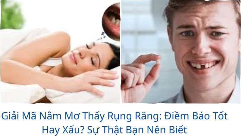 mo-thay-rung-rang