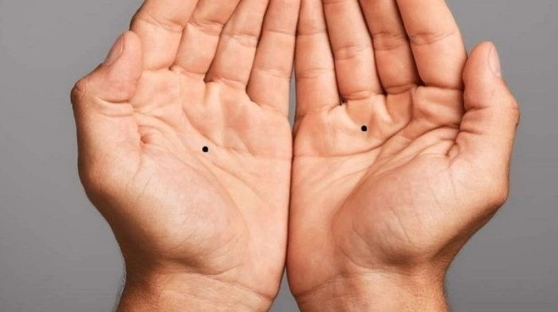 Nốt ruồi đen tiết lộ vận mệnh tiềm ẩn