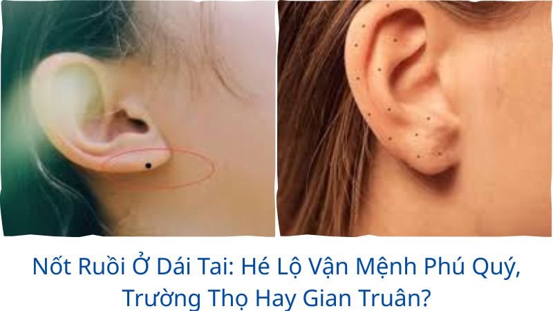 not-ruoi-o-dai-tai