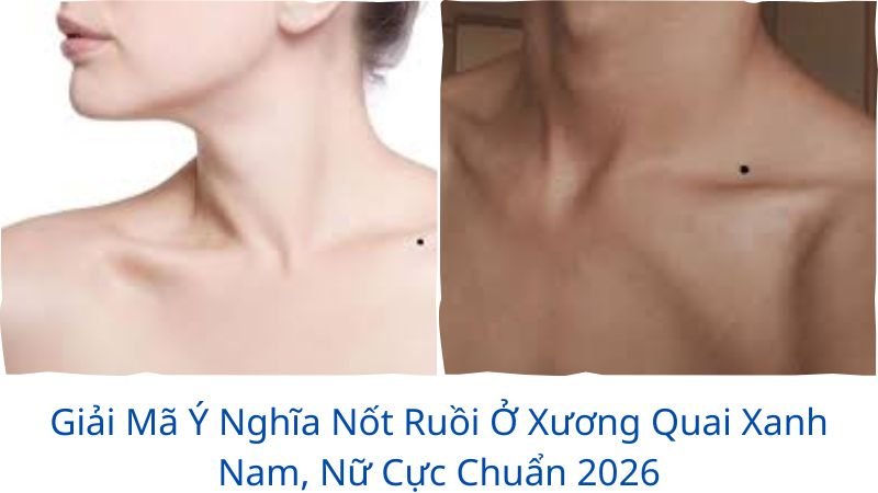 not-ruoi-o-xuong-quai-xanh