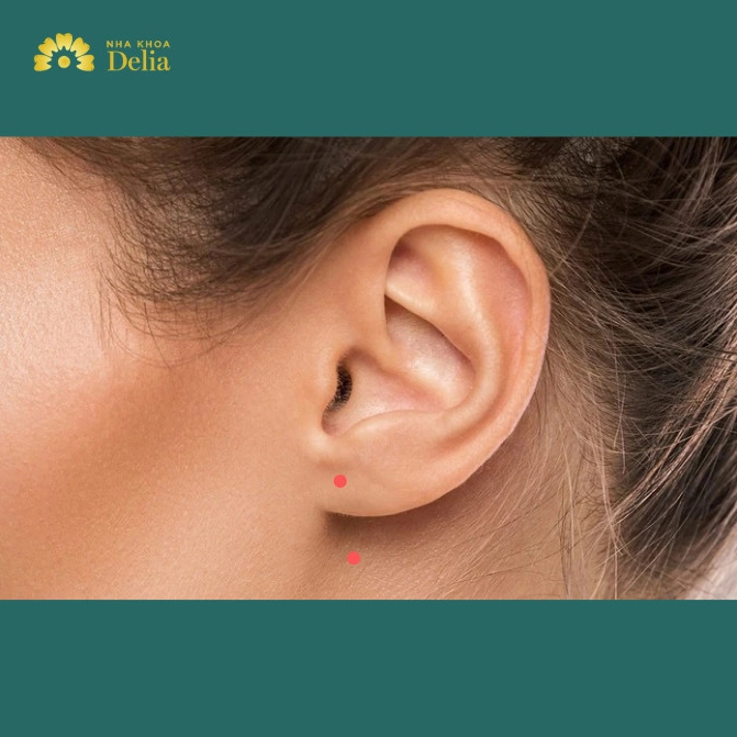 Nốt ruồi son trên tai có ý nghĩa gì?