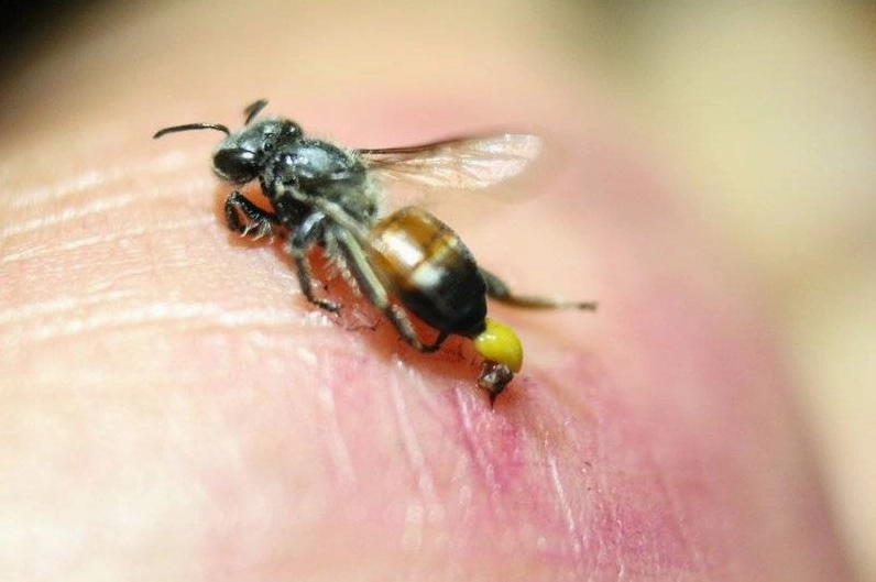 Tai nạn do ong đốt | Vinmec