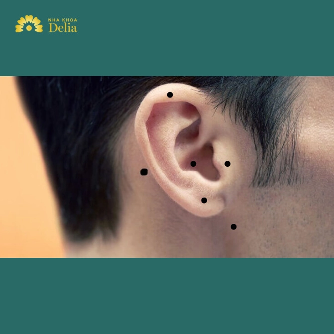Ý nghĩa nốt ruồi trên tai nam giới