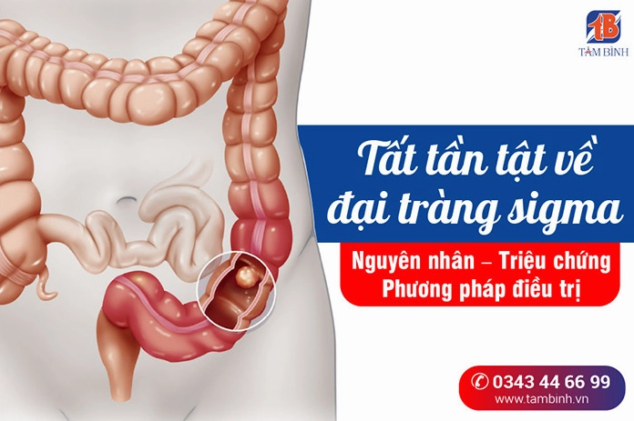 ai-trang-sigma-nguyen-nhan-trieu-chung-va-cach-ieu-tri-hieu-_881
