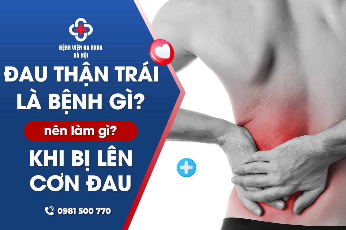 Đau thận trái là bệnh gì? Nên làm gì khi bị lên cơn đau?