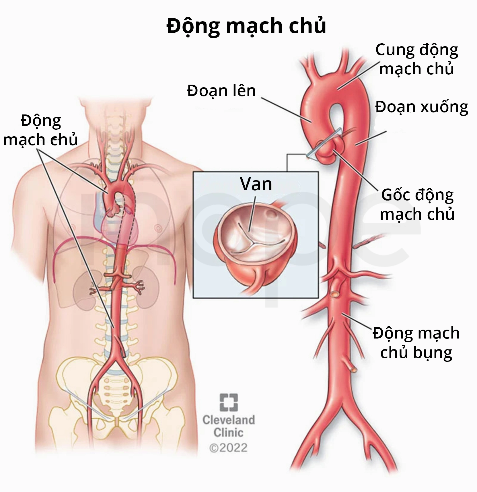 Biểu đồ minh họa các bệnh lý động mạch chủ