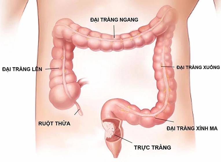 Cấu tạo của đại tràng