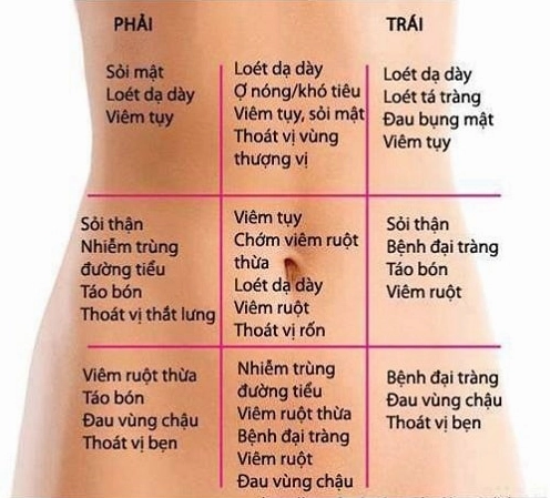 Hình ảnh minh họa các triệu chứng đau thượng vị và các bệnh lý liên quan
