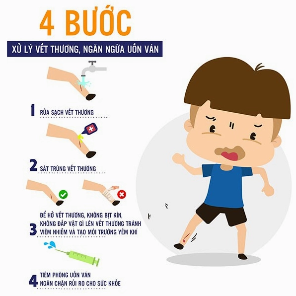 Hình ảnh minh họa vi khuẩn uốn ván