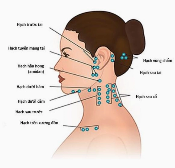Hình ảnh minh họa vị trí các hạch bạch huyết ở cổ
