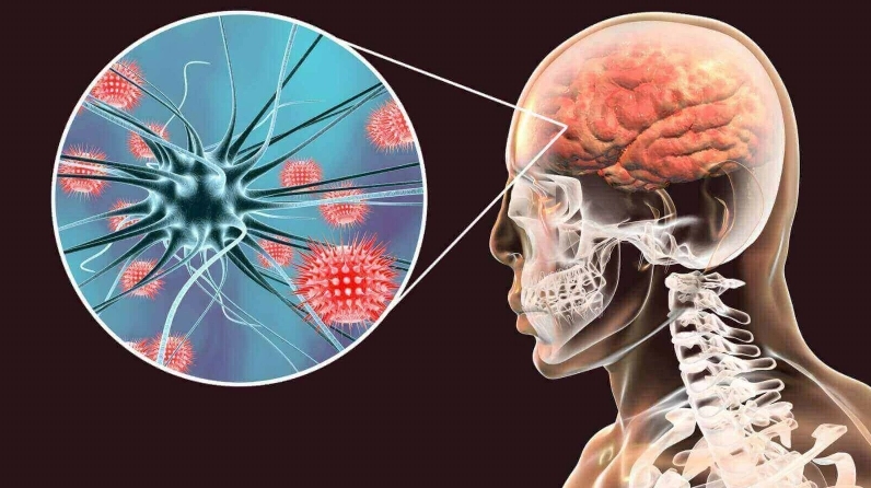 Hình ảnh một em bé có triệu chứng viêm màng não