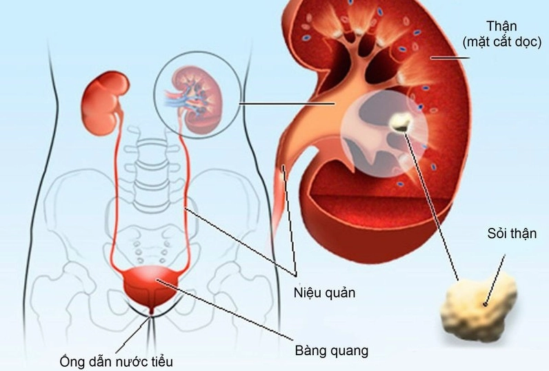 Hình ảnh người đang sử dụng giấy thử pH để đo nước tiểu