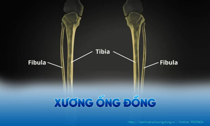 Hoạt động thể chất liên quan đến xương ống đồng