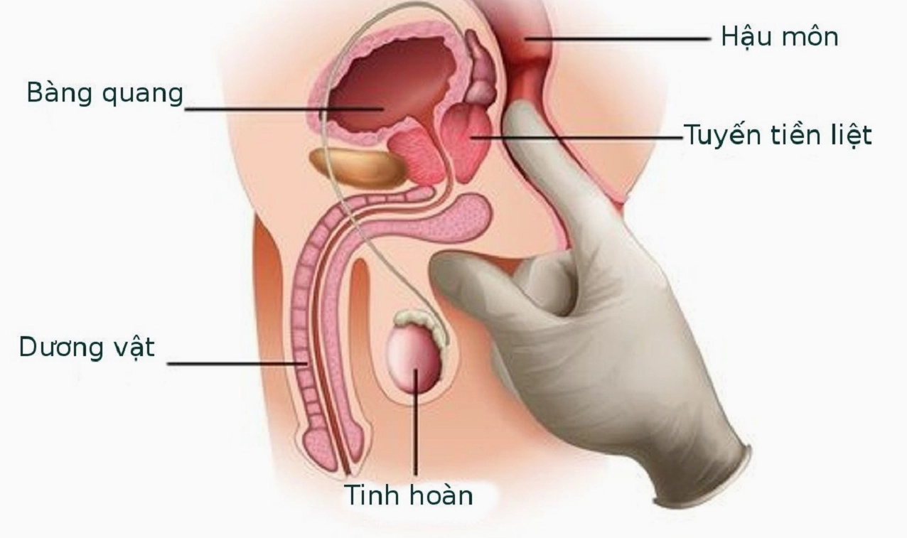 Khám hệ tiết niệu