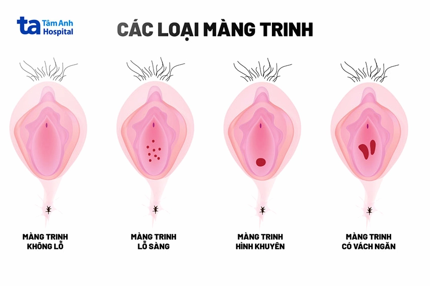 mang-trinh-la-gi-tat-tan-tat-nhung-ieu-ban-can-biet_326