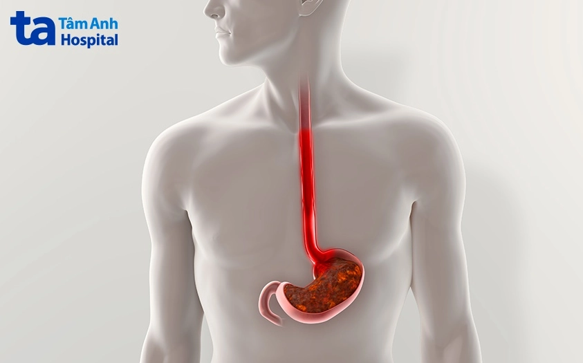 Minh họa vị trí thực quản trong cơ thể người
