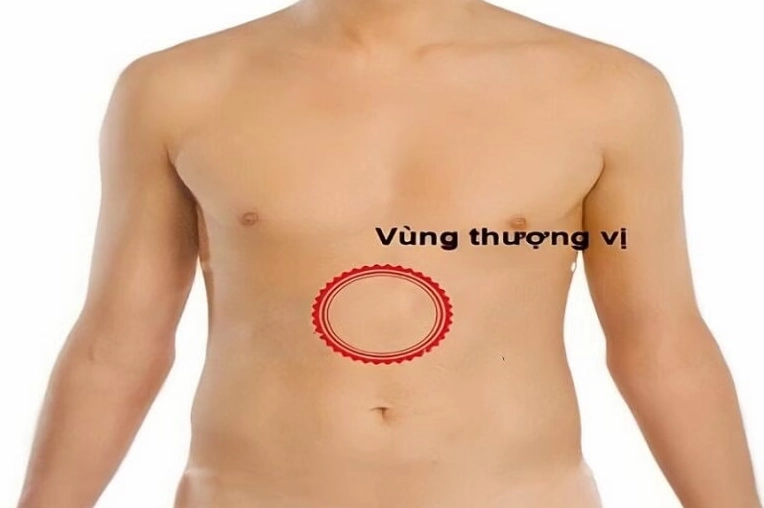 Minh họa vị trí vùng thượng vị trên cơ thể người