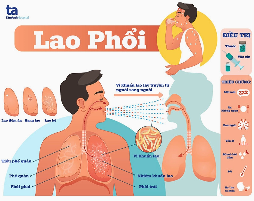 Người bệnh lao phổi ho