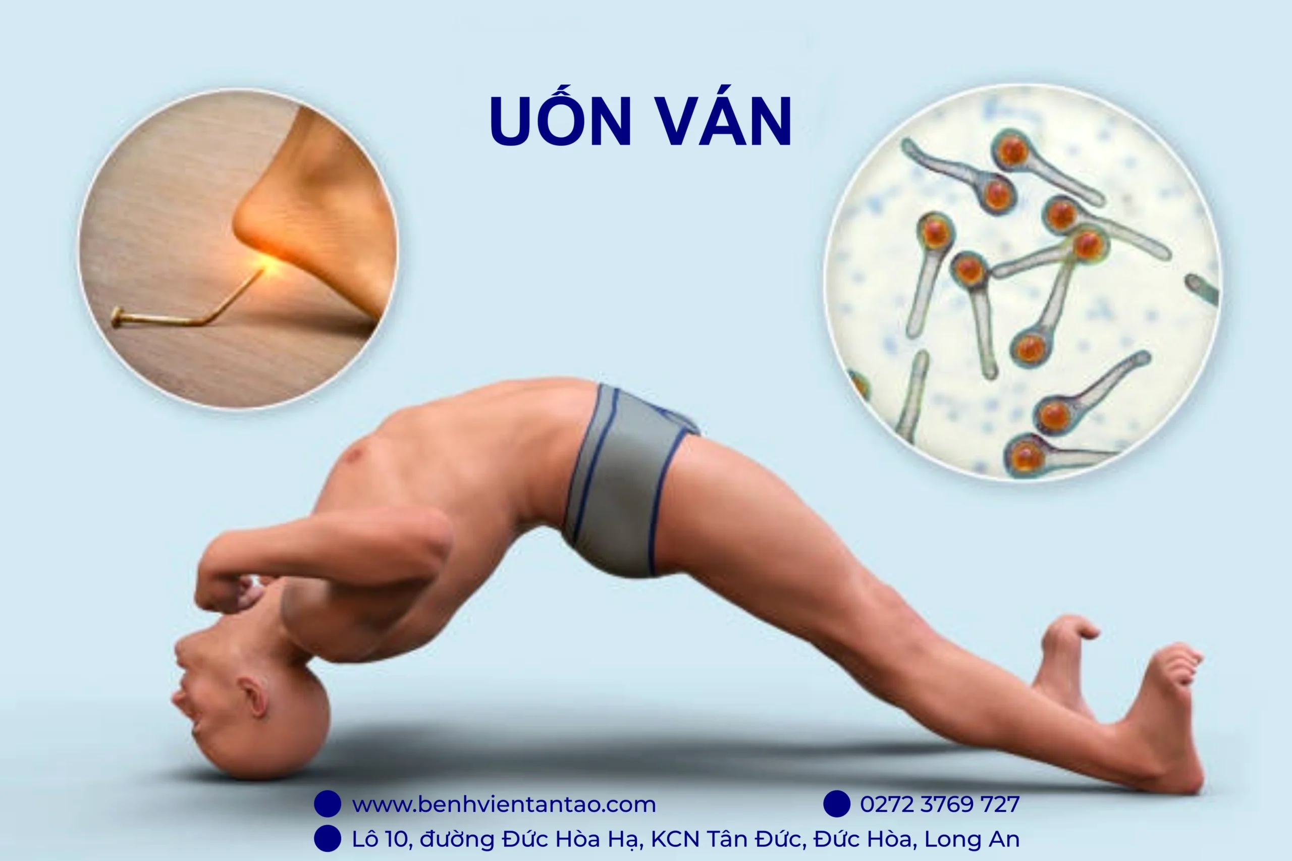Tiêm vắc-xin là cách phòng ngừa uốn ván hiệu quả