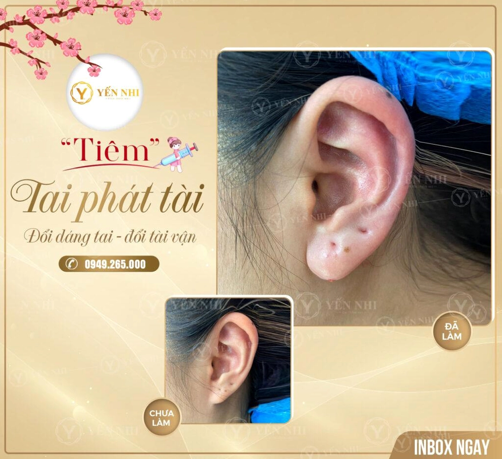 Tướng tai tài lộc với dái tai đầy đặn