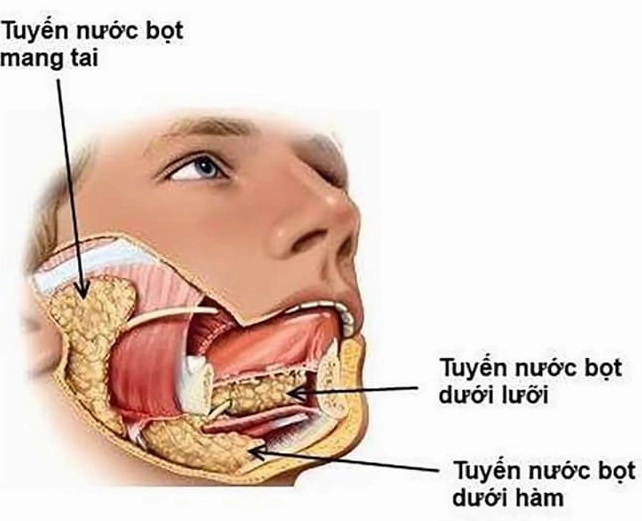 Tuyến nước bọt mang tai