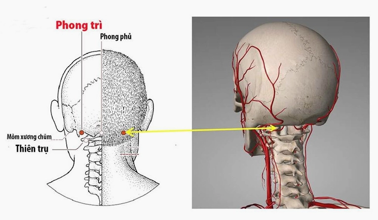 Vị trí huyệt Phong Trì trên cổ