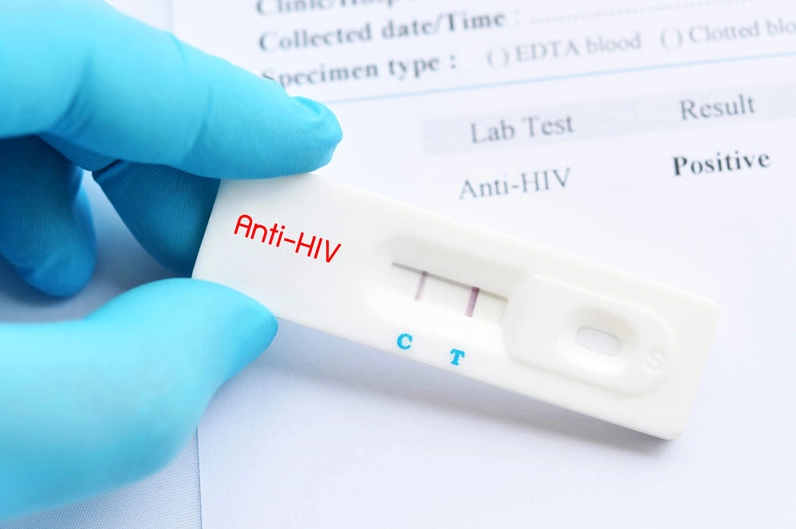 xet-nghiem-hiv-bao-nhieu-tien-cap-nhat-chi-phi-2026_171